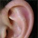 Операция «чистые уши»