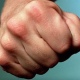 В Курске вор сломал челюсть охраннику магазина