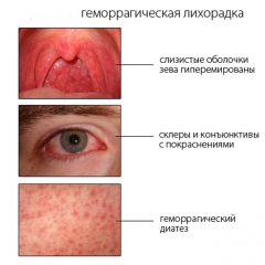 Четверо курян заболели геморрагической лихорадкой Четверо курян заболели геморрагической лихорадкой