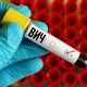 За год в Курской области выявлено 243 ВИЧ-инфицированных