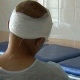 Курянин сломал лобную кость, дважды упав «с высоты собственного роста»