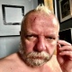 Под Курском участнику «Битвы экстрасенсов» разбили голову тростью