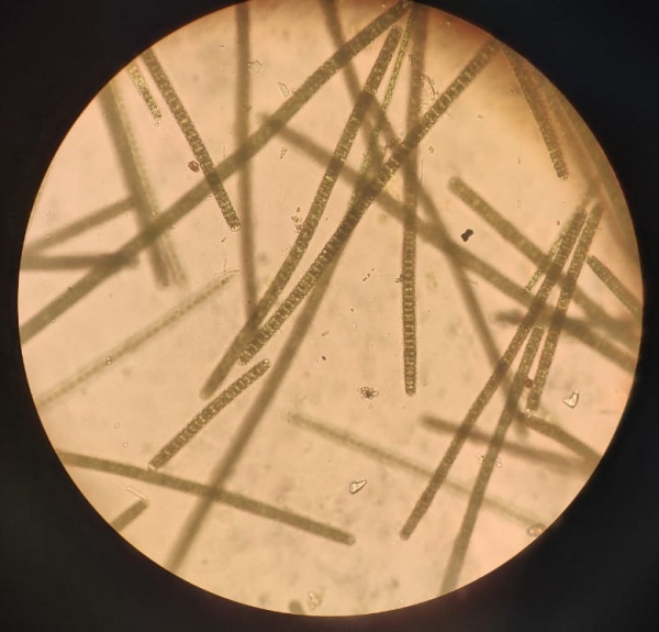 Это единственная плантация Spirulina platensis в нашей стране. В естественной среде спирулина растет в двух местах на планете – в Мексике и Центральной Африке. Курская много лет назад доставлена из озера Чад для ученого МГУ Михаила Лямина родом из Понырей Это единственная плантация Spirulina platensis в нашей стране. В естественной среде спирулина растет в двух местах на планете – в Мексике и Центральной Африке. Курская много лет назад доставлена из озера Чад для ученого МГУ Михаила Лямина родом из Понырей